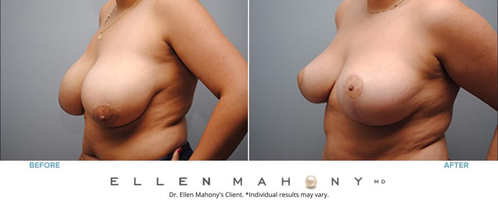 Before and After Image: Case #4862 - left-front-oblique