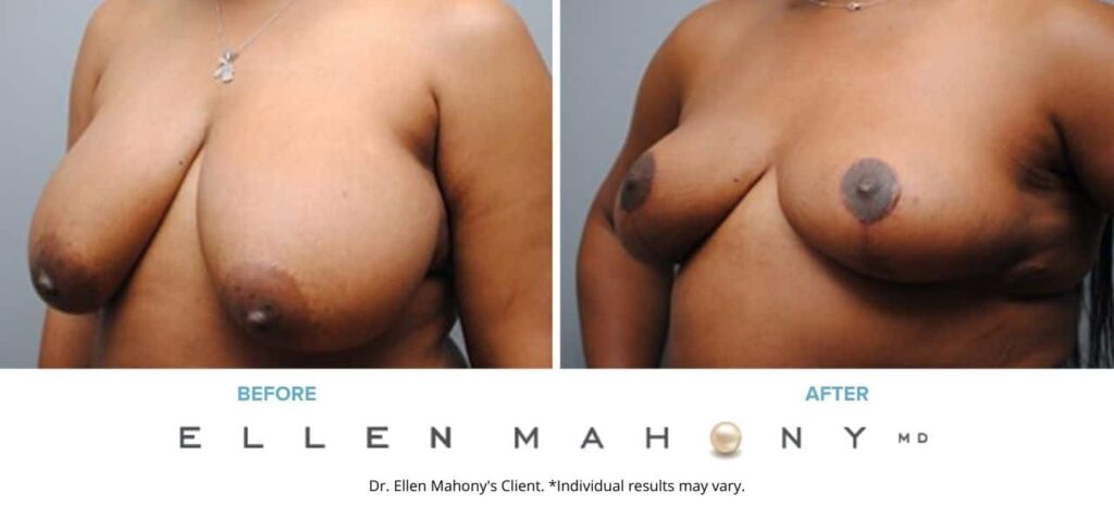 Before and After Image: Case #5190 - left-front-oblique