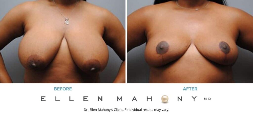 Before and After Image: Case #5190 - front