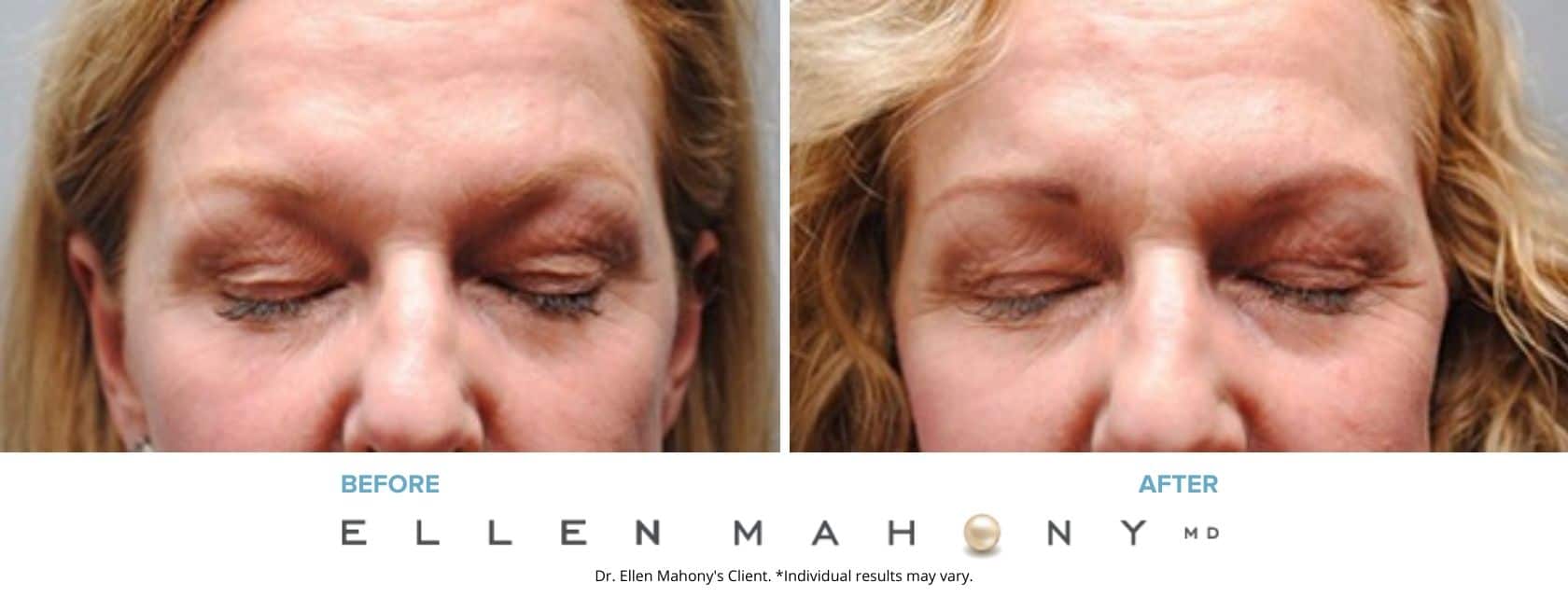 Before and After Image: Case #5310 - front