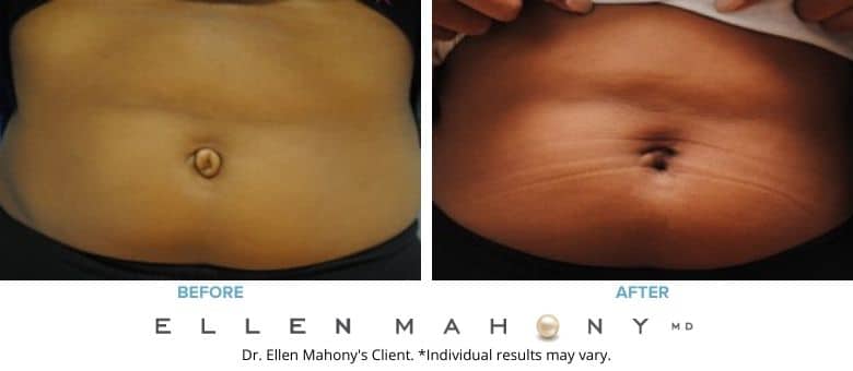 Before and After Image: Case #5422 - front