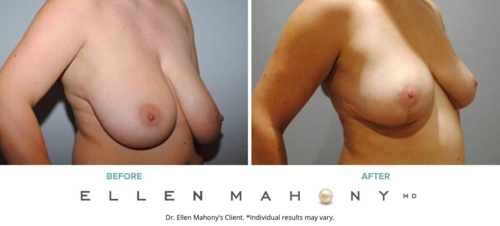 Before and After Image: Case #6104 - right-front-oblique