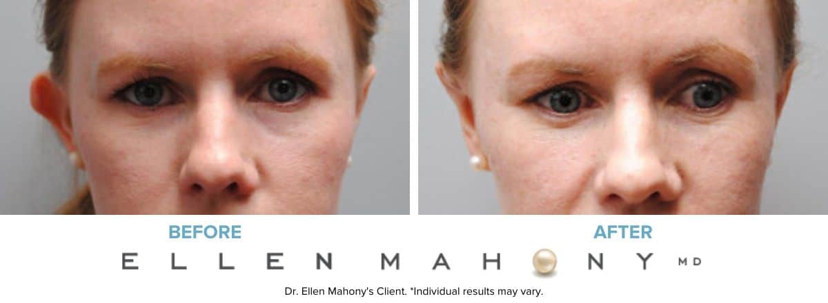 Before and After Image: Case #6131 - front
