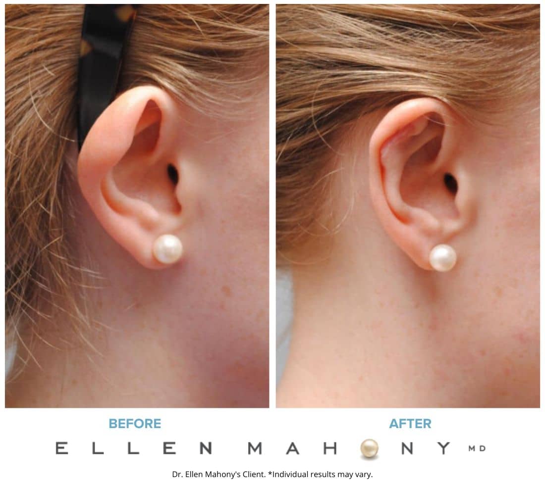 Before and After Image: Case #6131 - right-side