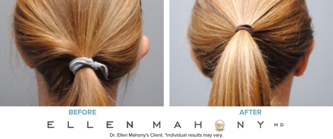 Before and After Image: Case #6131 - back