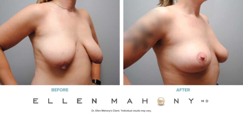Before and After Image: Case #6172 - right-front-oblique