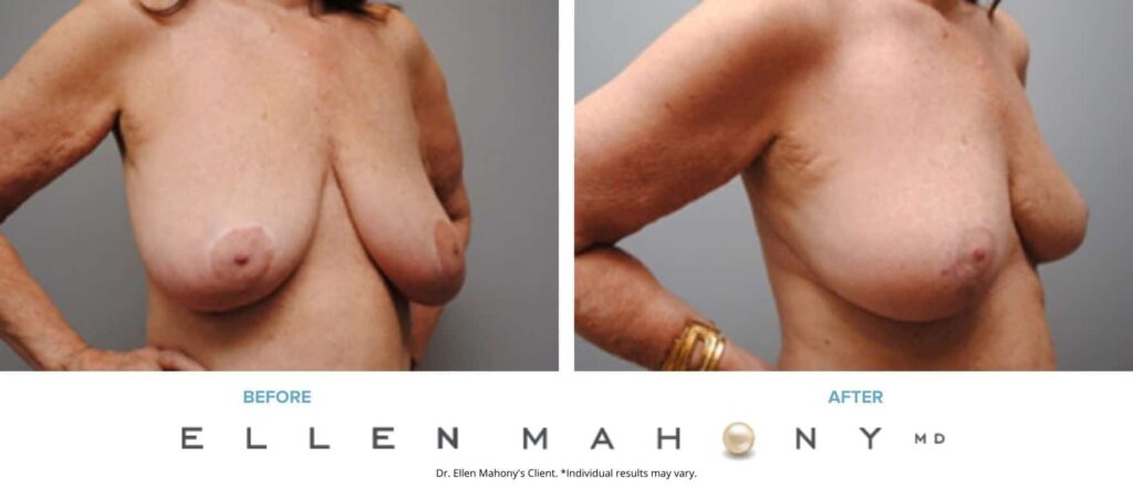 Before and After Image: Case #6216 - right-front-oblique