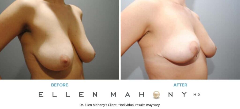 Before and After Image: Case #6244 - right-front-oblique