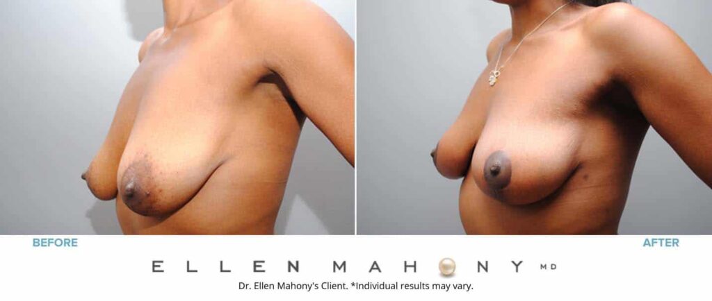 Before and After Image: Case #6448 - left-front-oblique