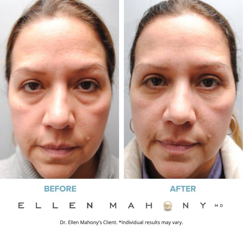 Before and After Image: Case #6516 - front