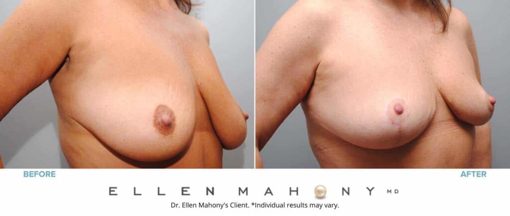 Before and After Image: Case #6734 - right-front-oblique