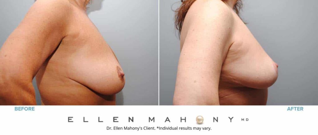 Before and After Image: Case #6734 - right-side