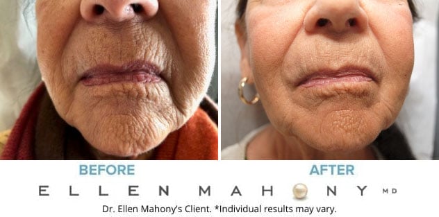 Before and After Image: Case #7310 - front