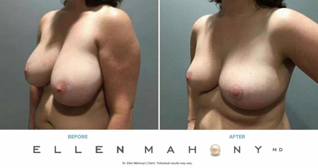 Before and After Image: Case #7346 - left-front-oblique