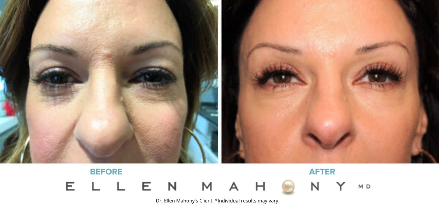 Before and After Image: Case #7518 - front