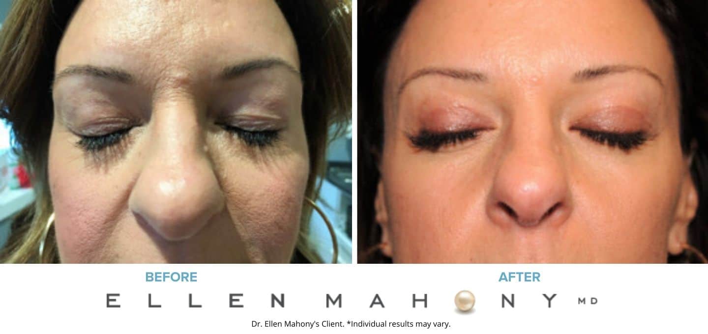 Before and After Image: Case #7518 - front