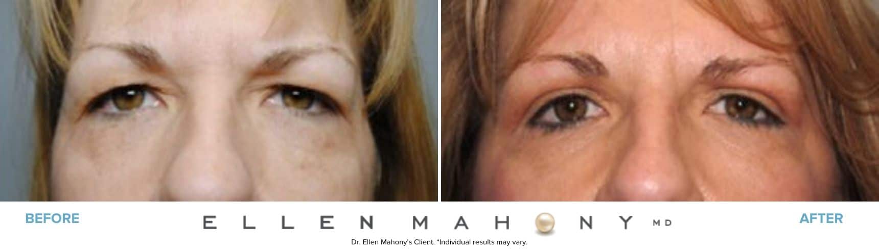 Before and After Image: Case #7659 - front