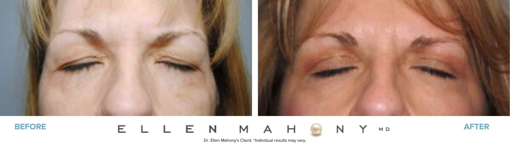 Before and After Image: Case #7659 - front