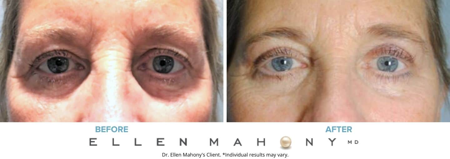 Before and After Image: Case #7738 - front