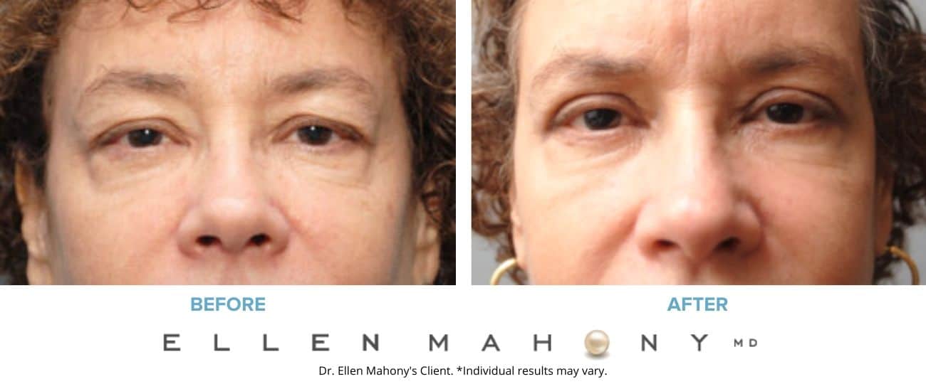 Before and After Image: Case #8192 - front