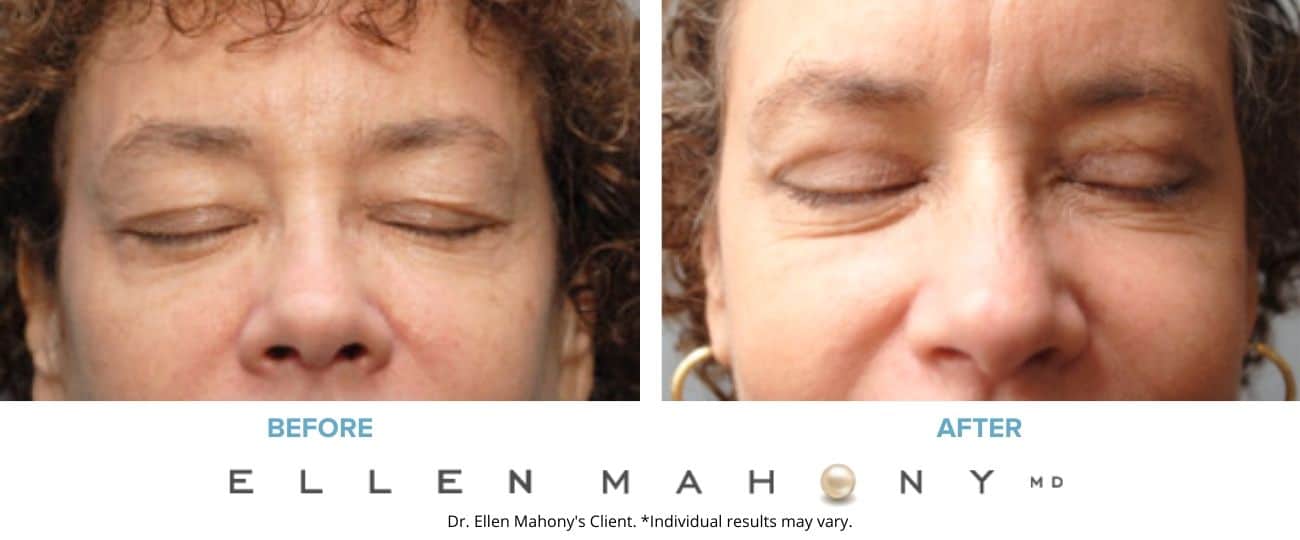 Before and After Image: Case #8192 - front