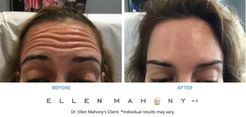 Before and After Image: Case #8447 - front