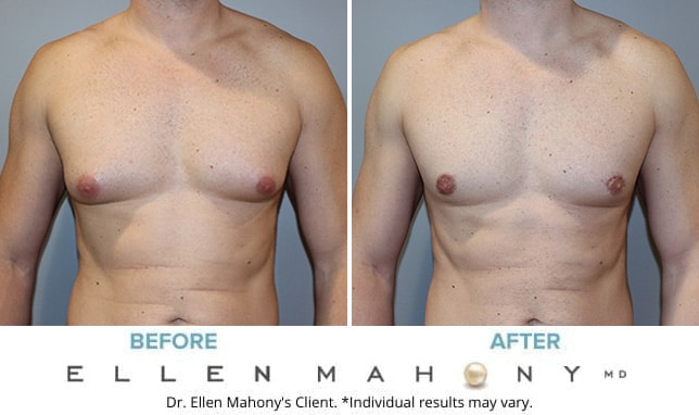 Before and After Image: Case #10583 - front