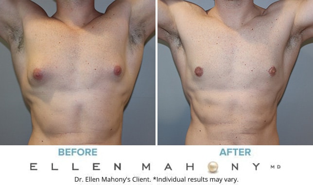 Before and After Image: Case #10583 - front