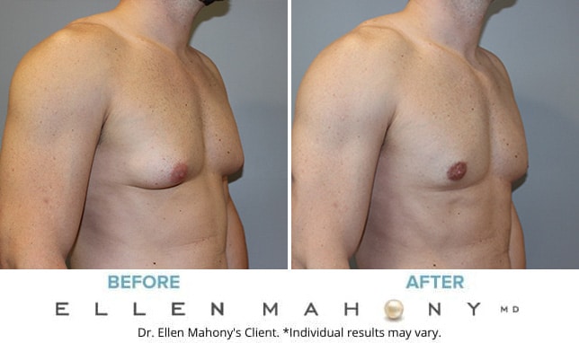 Before and After Image: Case #10583 - right-front-oblique
