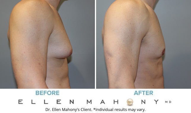 Before and After Image: Case #10583 - right-side