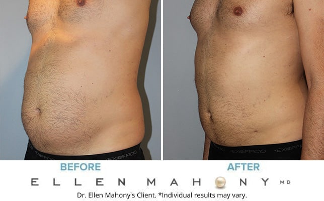 Before and After Image: Case #10588 - left-front-oblique