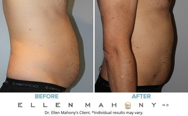 Before and After Image: Case #10588 - right-side