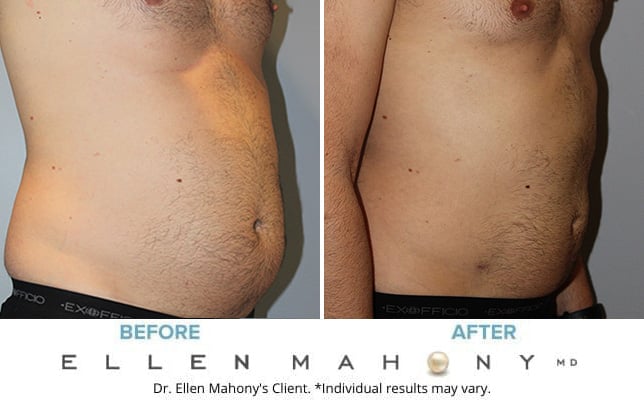 Before and After Image: Case #10588 - right-front-oblique