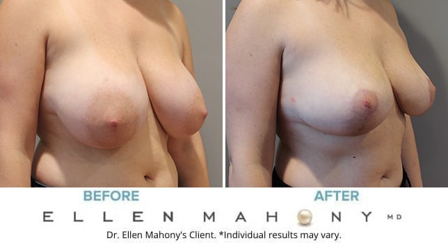 Before and After Image: Case #10783 - right-front-oblique