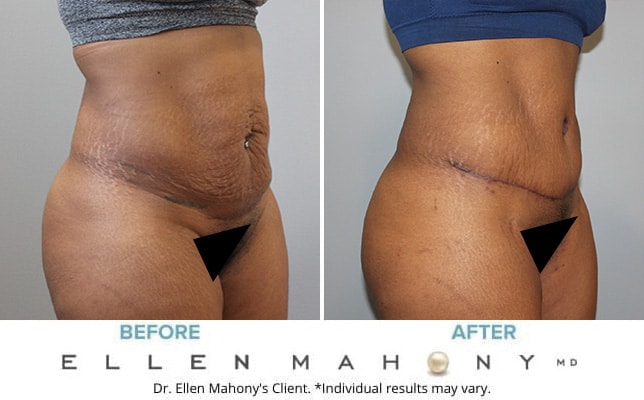 Before and After Image: Case #10803 - right-front-oblique