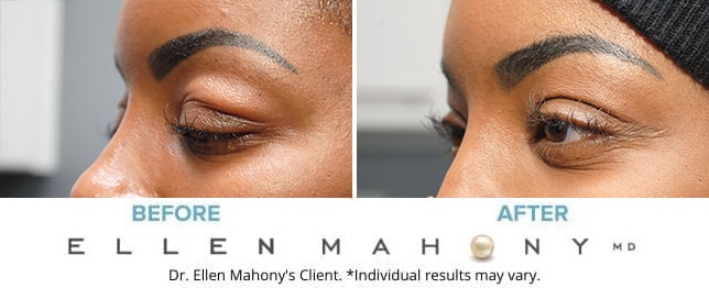 Before and After Image: Case #7165 - left-front-oblique