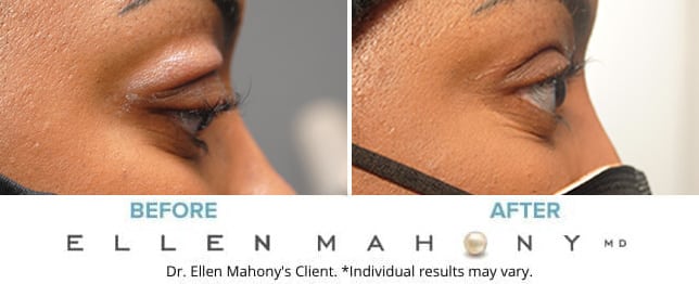 Before and After Image: Case #7165 - right-side