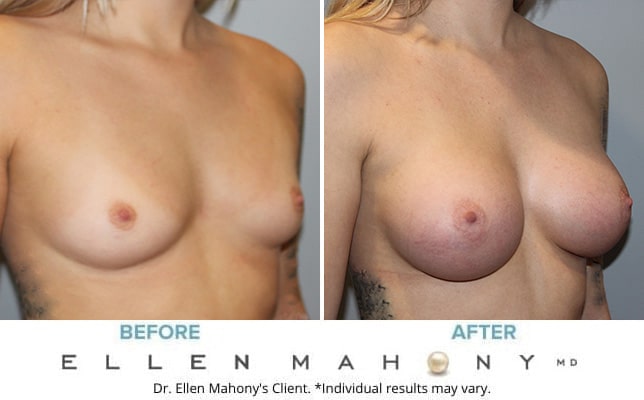 Before and After Image: Case #8342 - right-front-oblique