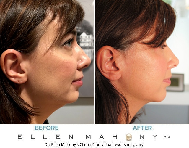 Before and After Image: Case #8669 - right-side