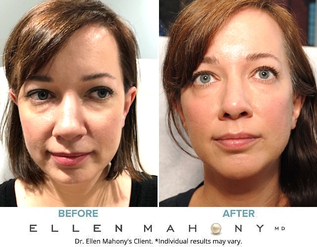Before and After Image: Case #8669 - front