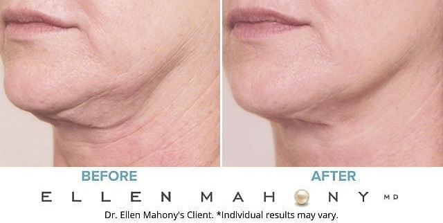 Before and After Image: Case #8796 - left-front-oblique