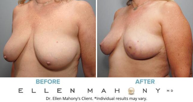 Before and After Image: Case #8831 - left-front-oblique