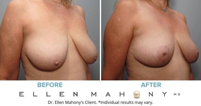 Before and After Image: Case #8831 - right-front-oblique
