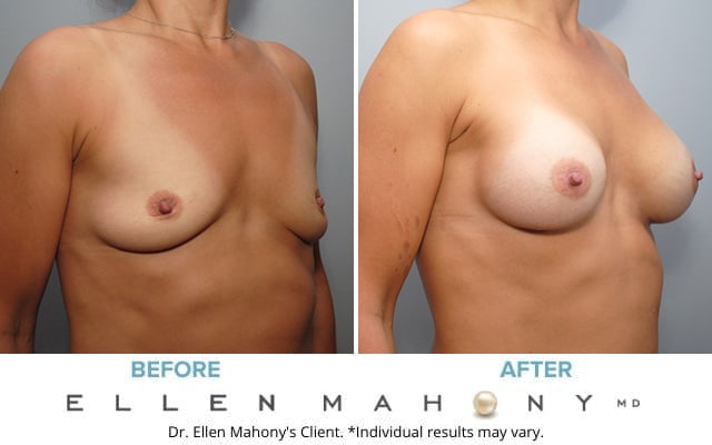 Before and After Image: Case #8909 - right-front-oblique