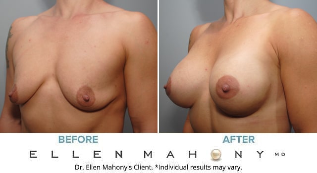 Before and After Image: Case #8927 - left-front-oblique