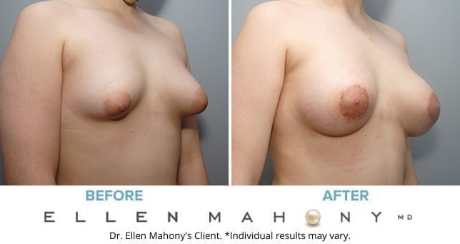 Before and After Image: Case #8982 - right-front-oblique