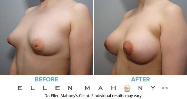 Before and After Image: Case #8982 - left-front-oblique