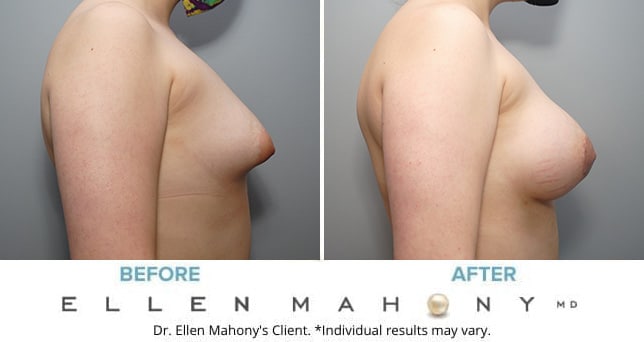 Before and After Image: Case #8982 - right-side