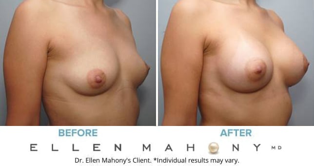 Before and After Image: Case #8993 - right-front-oblique