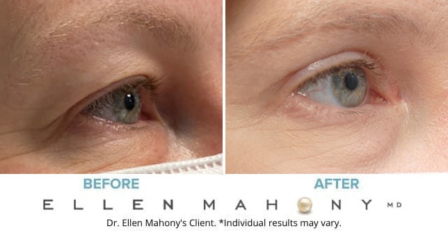 Before and After Image: Case #9071 - right-front-oblique